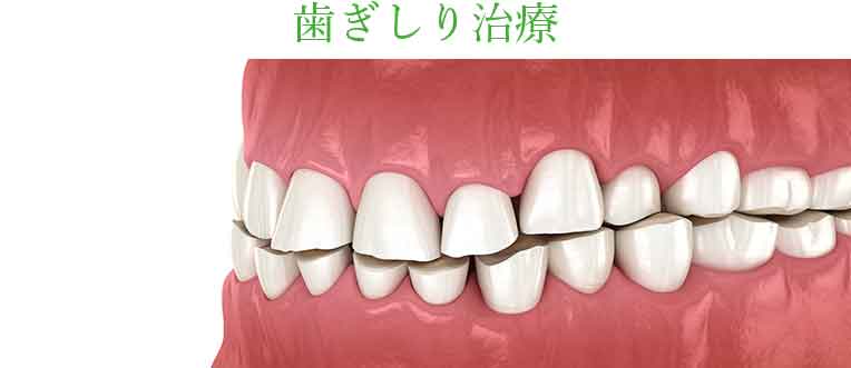 歯ぎしり治療