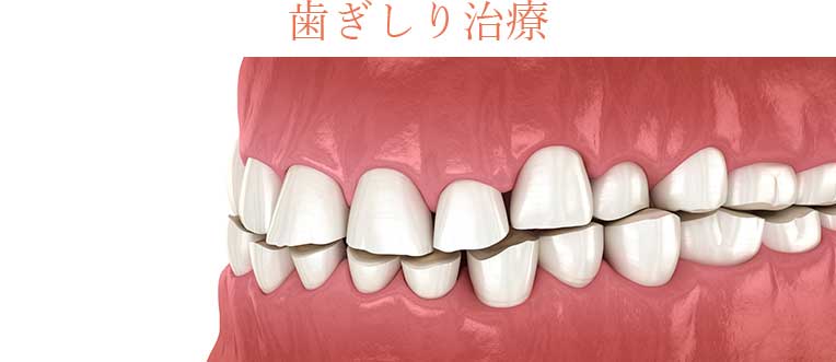 歯ぎしり治療